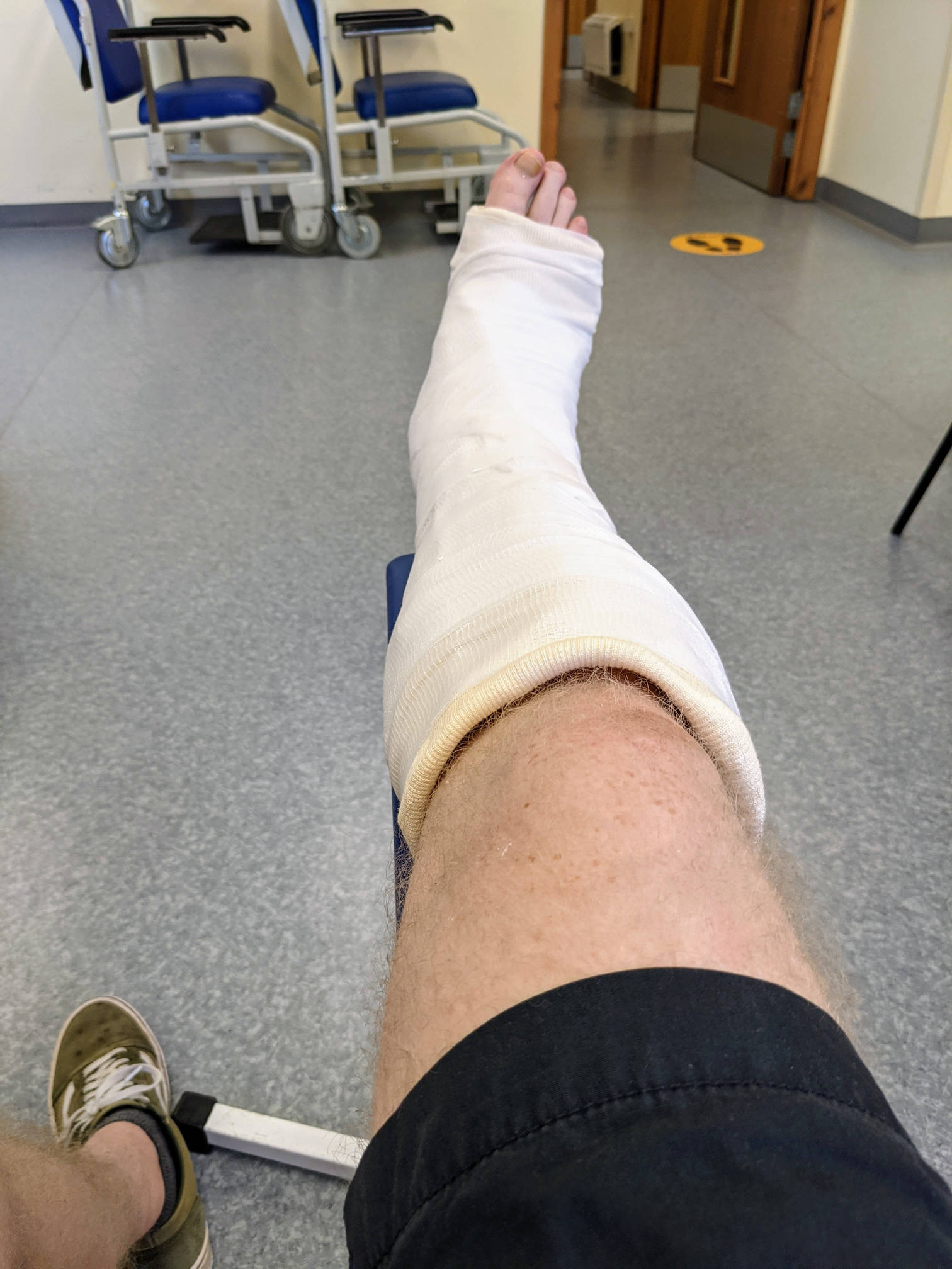 My right leg in a plastercast in a hospital waiting room