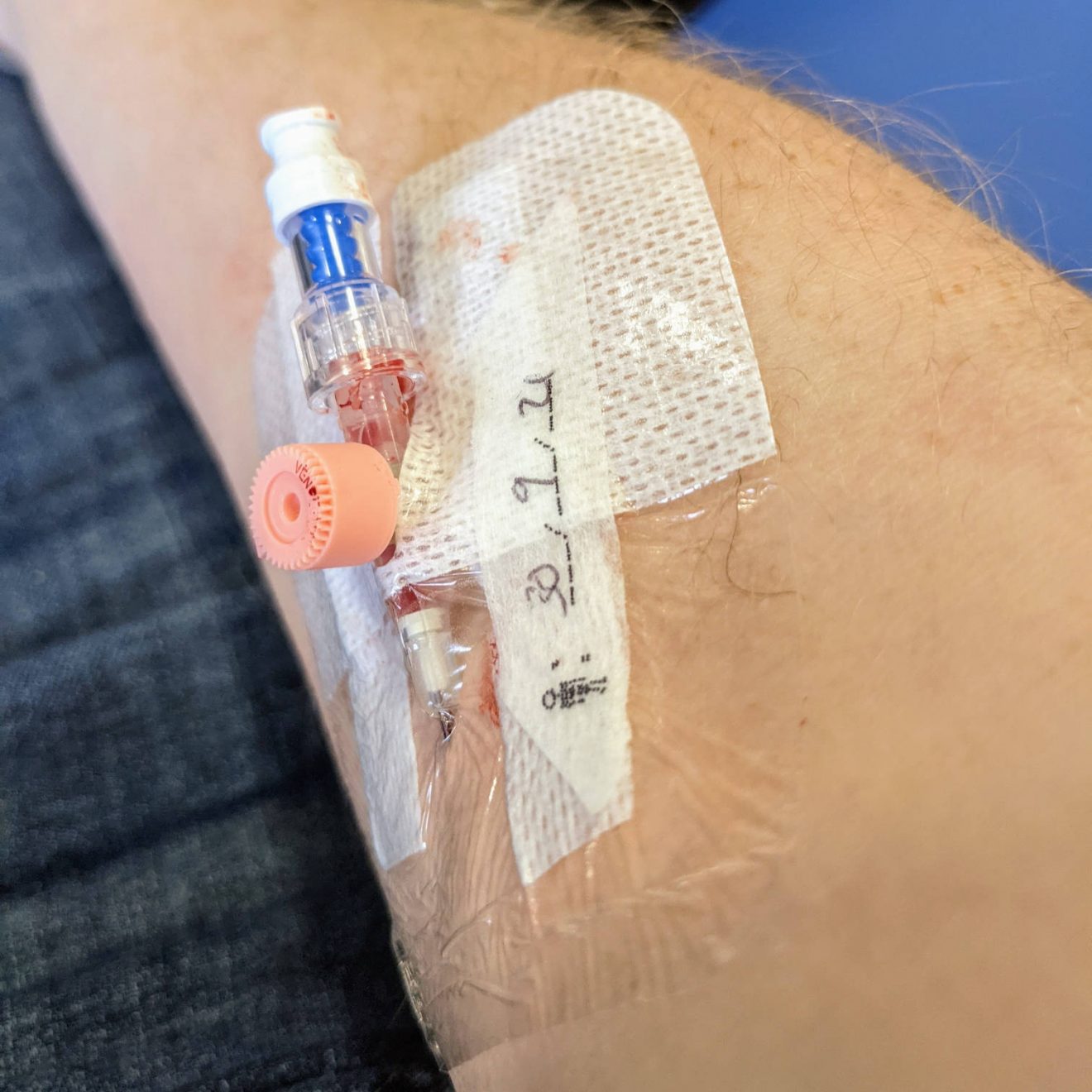 A cannula in my arm